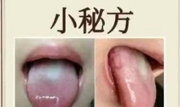 舌头溃疡可以吃凉瓜,缓解舌头溃疡困扰